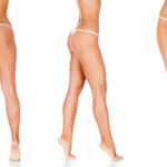 Lipoescultura